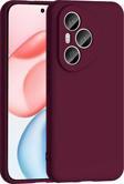Honor 400 Pro Kılıf Zore Mara Lansman Kapak