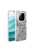Kılıftech Redmi Note 14 Pro 5G Kılıf Kamera Korumalı Figürlü Zore Ponti Silikon Kapak - Açık Mavi