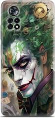 Miraksesuar Xiaomi Poco X4 Pro 5G Uyumlu Kılıf Yapayzeka 12 Joker Tasarım Kılıf