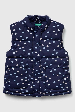 United Colors Of Benetton Kız Bebek 2V3Ygj00O-25K Desenli Yelek Lacivert - Image 1