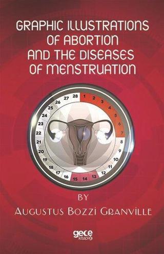 Graphic Illustrations of Abortion and the Diseases of Menstruation - Augustus Bozzi Granville - Gece Kitaplığı