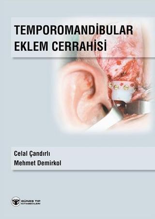 Temporomandibular Eklem Cerrahisi - Mehmet Demirkol - Güneş Tıp Kitabevleri