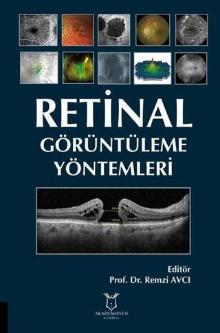 Retinal Görüntüleme Yöntemleri - Kolektif  - Akademisyen Kitabevi