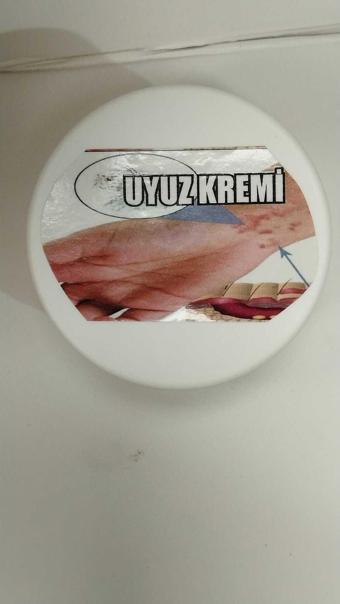 Uyuz Kremi 100ml