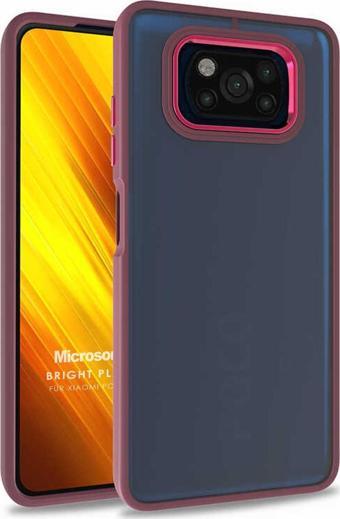 Microsonic Xiaomi Poco X3 NFC Kılıf Bright Planet Kırmızı