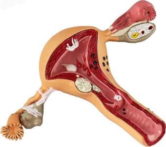 Uterus Pelvik Taban Maketi Model 41