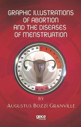 Graphic Illustrations of Abortion and the Diseases of Menstruation - Augustus Bozzi Granville - Gece Kitaplığı