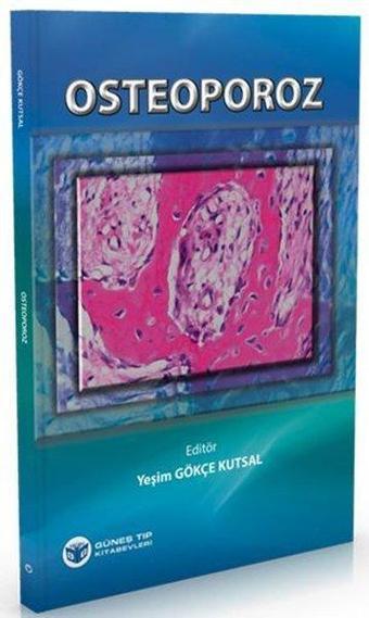 Osteoporoz - Güneş Tıp Kitabevleri