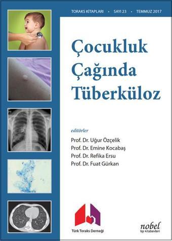 Çocukluk Çağında Tüberküloz - Kolektif  - Nobel Tıp Kitabevleri