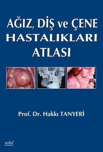 Ağız Diş ve Çene Hastalıkları Atlası - Kolektif  - Nobel Tıp Kitabevleri