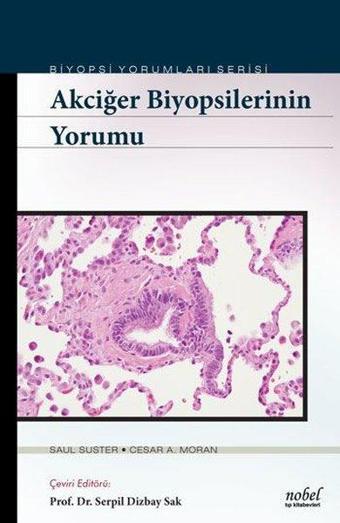 Biyopsilerin Yorumu: Akciğer - Kolektif  - Nobel Tıp Kitabevleri