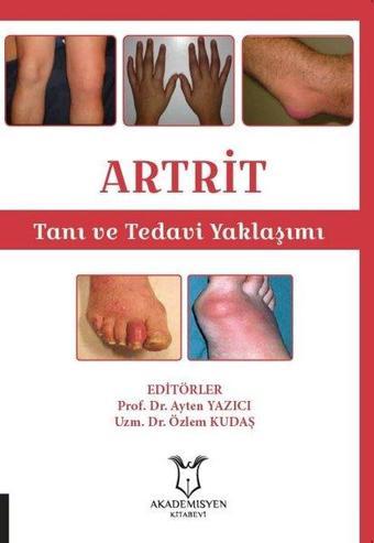 Artrit - Tanı ve Tedavi Yaklaşımı - Akademisyen Kitabevi