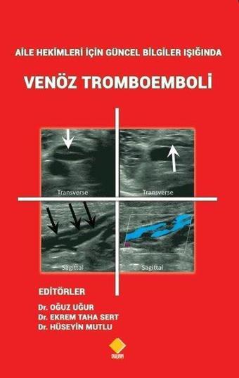 Aile Hekimleri için Güncel Bilgiler Işığında Venöz Tromboemboli - Kolektif  - Duvar Yayınları