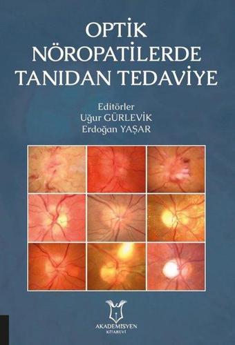 Optik Nöropatilerde Tanıdan Tedaviye - Akademisyen Kitabevi