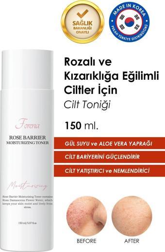 Forena Rozalı Ciltler Için Cilt Bariyer Onarımını Destekleyen Gül Suyu Özlü Nemlendirici Tonik 150 Ml