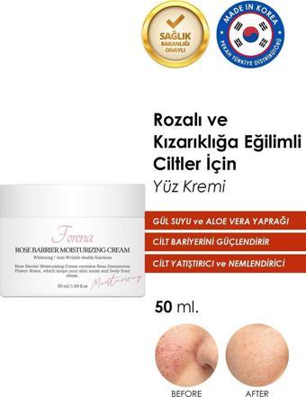 Forena Rozalı Ciltler Için Cilt Bariyer Onarımını Destekleyen Gül Suyu Özlü Nemlendirici Yüz Kremi 50 Ml