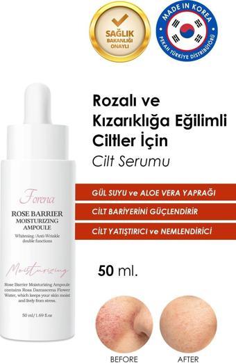 Forena Rozalı Ciltler Için Cilt Bariyer Onarımını Destekleyen Gül Suyu Özlü Nemlendirici Yüz Serumu 50 Ml