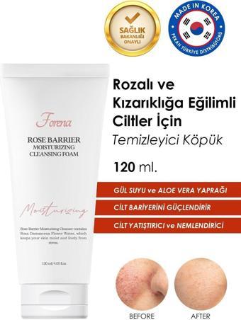 Forena Rozalı Ciltler Için Cilt Bariyer Onarımını Destekleyen Gül Suyu Özlü Temizleme Köpüğü 120 Ml