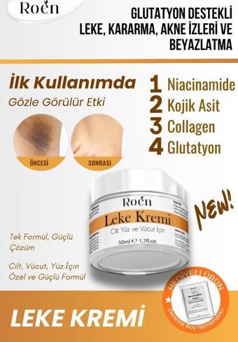 Roen Cilt Beyazlatıcı, Leke Kremi, Kararma, Akne, Güneş Lekeleri, Glutatyonlu Beyazlatıcı Leke Krem 50Ml