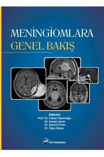 Us Akademi Meningiomlara Genel Bakış - Us Akademi