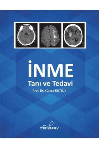 O Tıp Kitabevi Inme Tanı Ve Tedavi - O'tıp Kitabevi