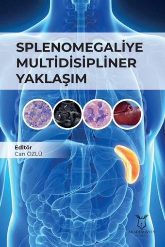 Akademisyen Yayınevi Splenomegaliye Multidisipliner Yaklaşım - Akademisyen Yayınevi