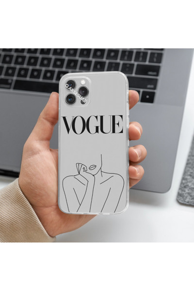 Q Aksesuar Xiaomi Redmi Note 11 Pro Uyumlu Vogue Tasarımlı Premium Şeffaf Telefon Kılıfı