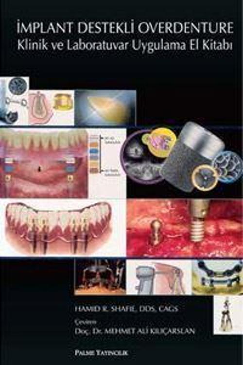 Palme Yayınevi İmplant Destekli Overdenture Klinik Ve Laboratuvar Uygulama El Kitabı