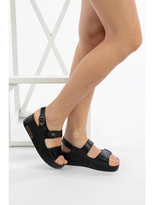 3014 SİYAH ÇIRTLI COMFORT CASUAL ANATOMİK SANDALET