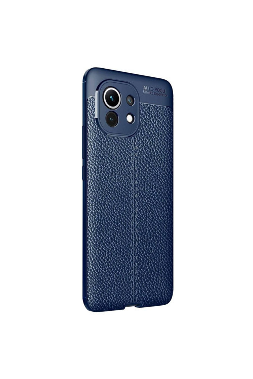 Xiaomi Mi 11 Deri Görünümlü Silikon Lacivert