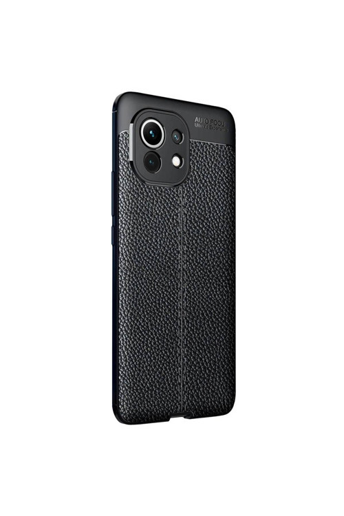 Xiaomi Mi 11 Deri Görünümlü Silikon Siyah