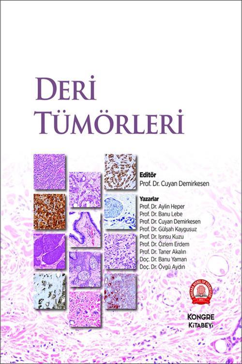 Deri Tümörleri