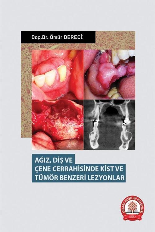 Ağız Diş Ve Çene Cerrahisinde Kist Ve Tümör Benzeri Lezyonlar