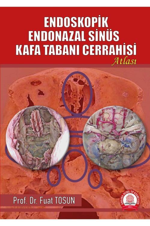 Endoskopik Endonazal Sinüs Kafa Tabanı Cerrahisi Atlası