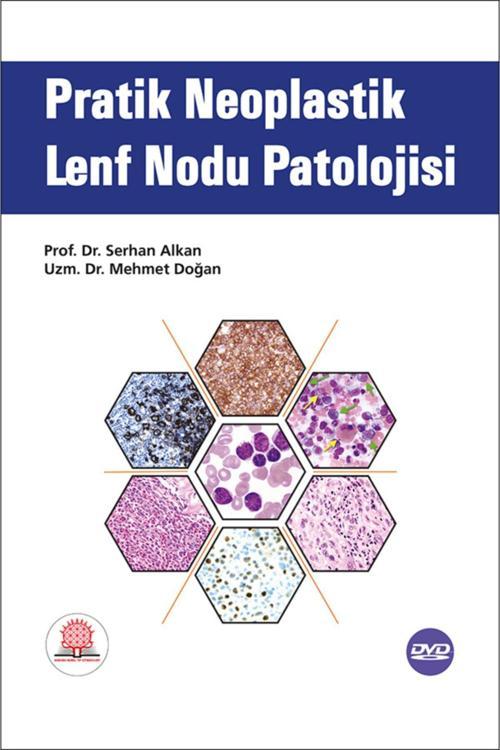 Pratik Neoplastik Lenf Nodu Patolojisi