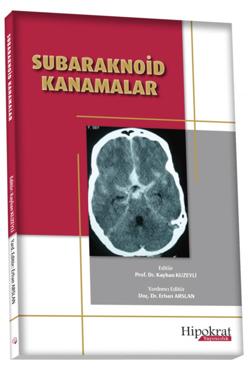 Subaraknoid Kanamalar Hipokrat Yayınevi