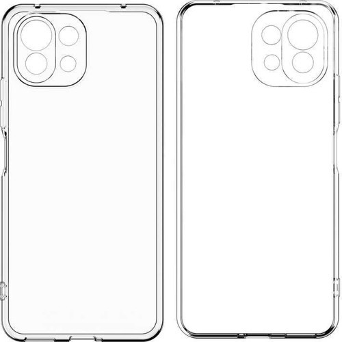 Xiaomi Mi 11 Kılıf Kamera Korumalı Süper Silikon Kapak