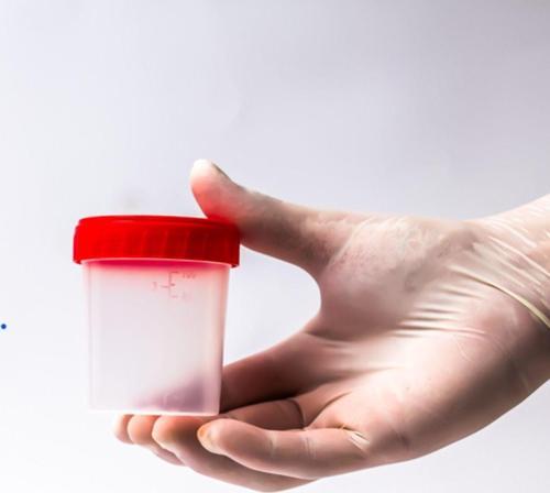Düz İdrar Kabı 100 Ml Steril 50 Adet