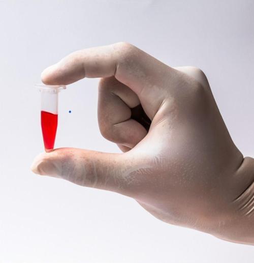 Eppendorf Tüpü 100 Adet