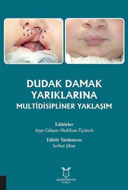 Dudak Damak Yarıklarına Multidisipliner Yaklaşım