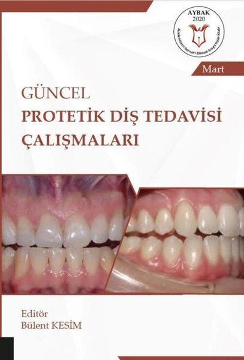 Güncel Protetik Diş Tedavisi Çalışmaları