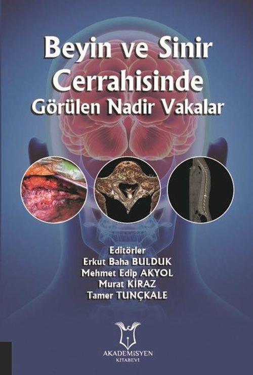 Beyin ve Sinir Cerrahisinde Görülen Nadir Vakalar