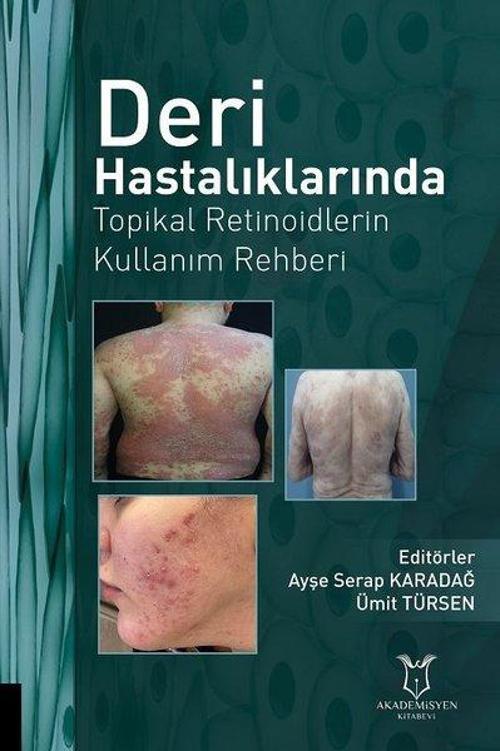 Deri Hastalıklarında Topikal Retinoidlerin Kullanım Rehberi