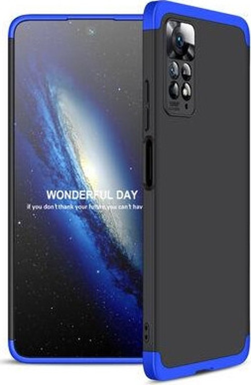 Redmi Note 11 Pro 5G Kılıf 3 Parçalı Tam Koruma Şık Astrea Premium Sert Kapak