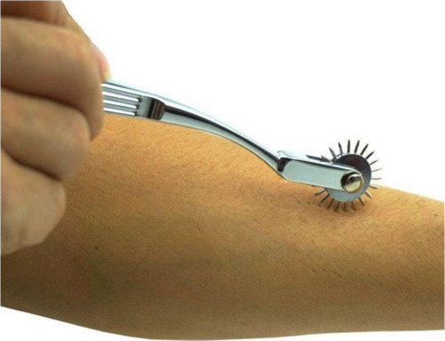 Wartenberg Pinwheel