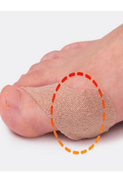 Ayak Başparmak Valgus Ortopedik Başparmak Tendon Kılıfı Parmak Koruma Bandı 5 Çift