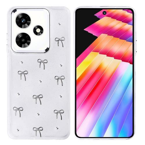 İnfinix Hot 30 Uyumlu Kamera Korumalı Kiraz-Fiyonk Figürlü Silikon Kapak