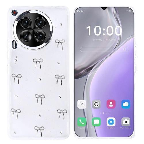 Tecno Camon 30 Uyumlu Kamera Korumalı Kiraz-Fiyonk Figürlü Silikon Kapak