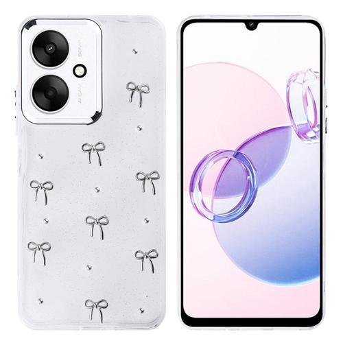 Xiaomi Redmi 13C Uyumlu Kamera Korumalı Kiraz-Fiyonk Figürlü Silikon Kapak