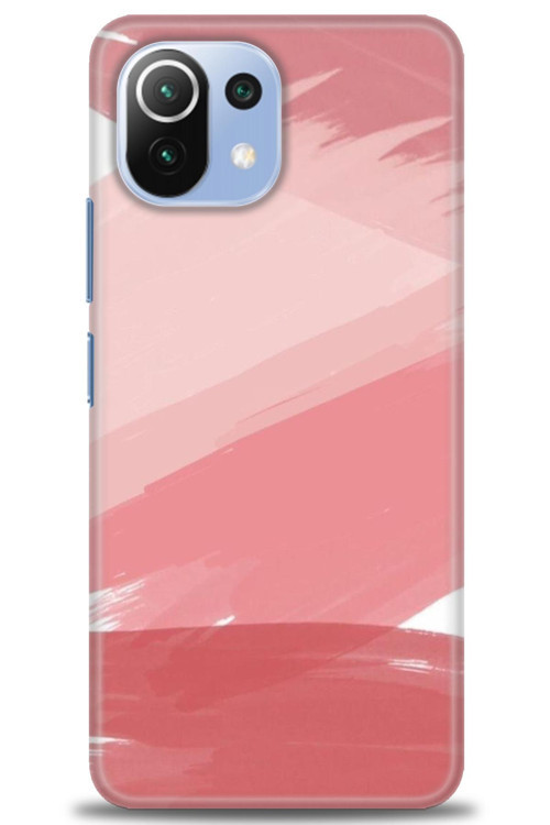 Xiaomi Mi 11 Lite Kılıf HD Baskılı Kılıf - Pembe Palet
